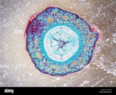 Microscopia di un campione di liquor con evidenza di cellule anomale o microrganismi