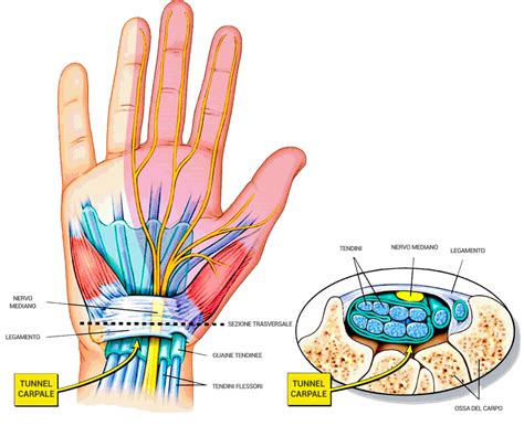 Diagramma della mano con evidenziato il tunnel carpale
