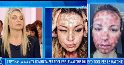 metafora delle cicatrici dell'anima dopo il peccato