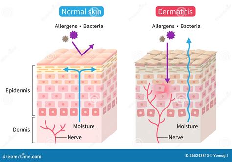 Illustrazione delle diverse manifestazioni cutanee della dermatite atopica, seborroica e da contatto.