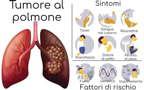 Infografica sull'incidenza e i fattori di rischio del tumore al polmone
