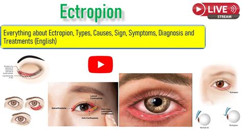 Foto di un ectropion in via di riparazione spontanea