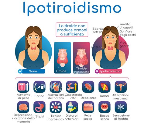 Rappresentazione grafica: Impatto ipotiroidismo sulla salute mentale