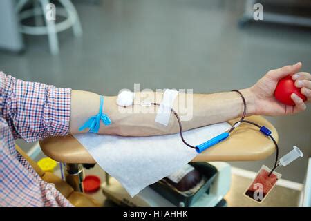 Foto di un braccio durante la donazione di sangue in un ambiente ospedaliero pulito e professionale