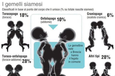 Infografica/Schema delle tipologie di gemelli siamesi, evidenziando i craniopagi totali
