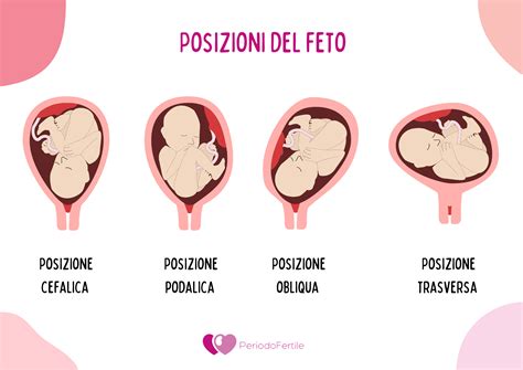 Schema che illustra la posizione corretta del feto nel bacino materno prima del parto