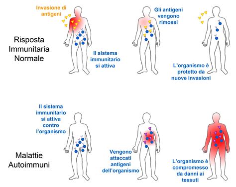 Infografica sulla relazione tra UV, sistema immunitario e malattie della pelle
