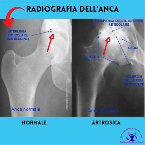 Radiografia di un'anca canina con indicazione del grado di displasia
