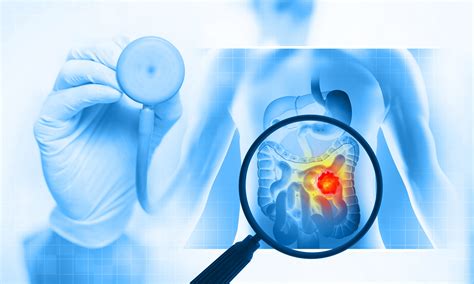 infografica sui metodi diagnostici per il tumore del colonretto