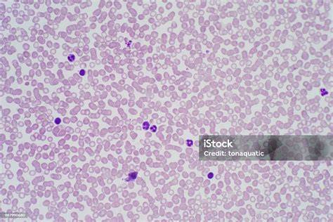 Microscopic image of human tissue or blood cells, labeled as from a Eucharistic miracle