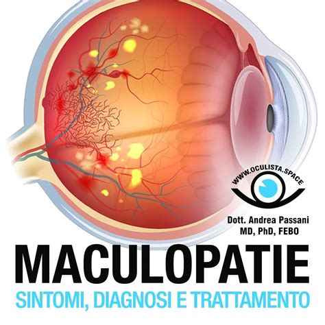 Infografica sulle patologie oculari trattate (glaucoma, retinopatia diabetica, maculopatie, cheratocono) o foto di strumentazione per campo visivo computerizzato