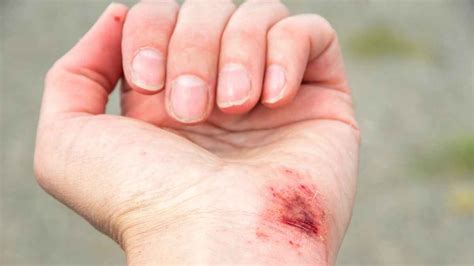 schema che illustra il concetto di peccato come ferita dell'anima e l'indulgenza come processo di guarigione e purificazione.