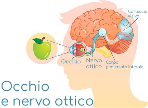 Schema anatomico del nervo ottico sano e del nervo ottico danneggiato dal glaucoma