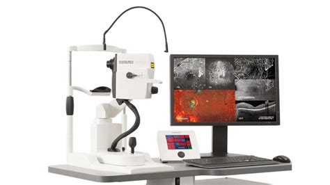 Immagine di una scansione OCT (Tomografia a Coerenza Ottica)