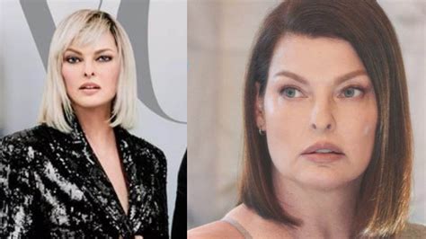 Linda Evangelista in un recente ritratto, che mostra i segni della procedura