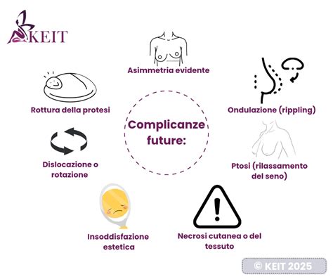 Infografica sulle complicanze dell'ernia: incarceramento e strozzamento
