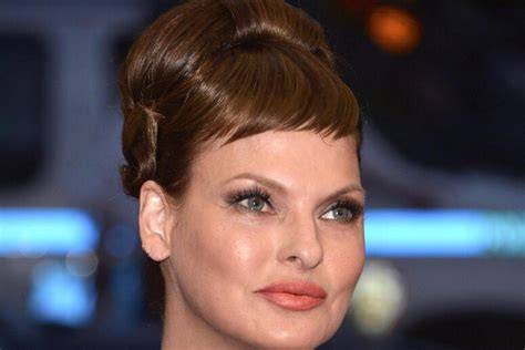 Immagine di Linda Evangelista dopo la procedura estetica