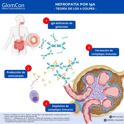 Schema genetico dell'APOL1 e sua associazione con la nefropatia