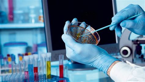 Infografica sulla sorveglianza della Listeriosi o un laboratorio di analisi microbiologiche