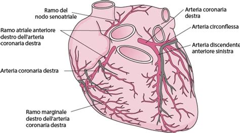 Schema che illustra un'arteria coronarica normale e una con aneurismi multipli che formano l'aspetto a corona di rosario.