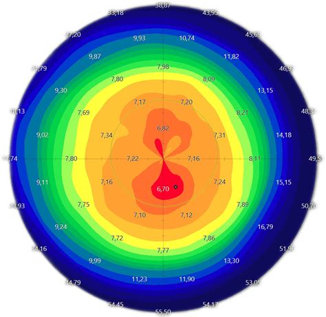 Esempio di mappa topografica corneale con aree evidenziate