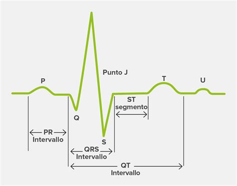 Schema semplificato di un elettrocardiogramma che mostra le onde P, QRS e T